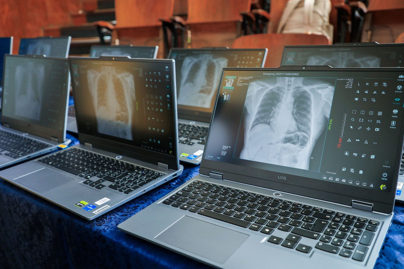 TECNOLOGÍA INTELIGENTE REFUERZA EL DIAGNÓSTICO DE TUBERCULOSIS EN LORETO