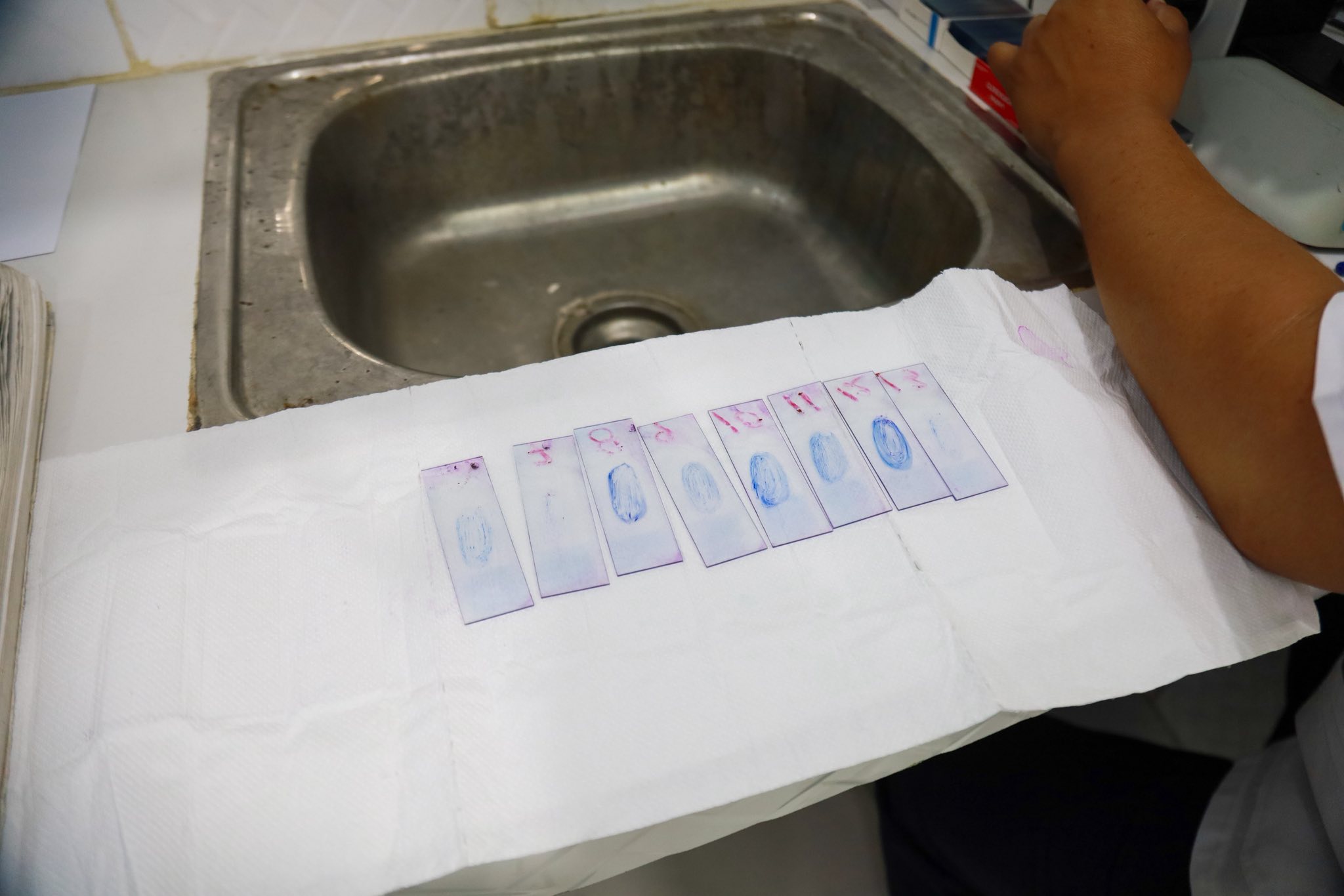 SERVICIO DE LABORATORIO DE LA IPRESS I- 4 MORONACOCHA AL SERVICIO DE LA POBLACIÓN